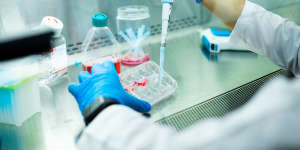 Liquid Biopsies